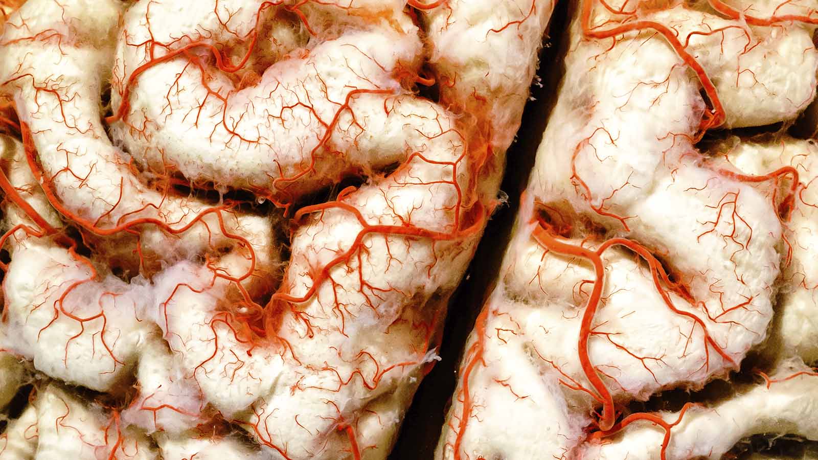brain-cells